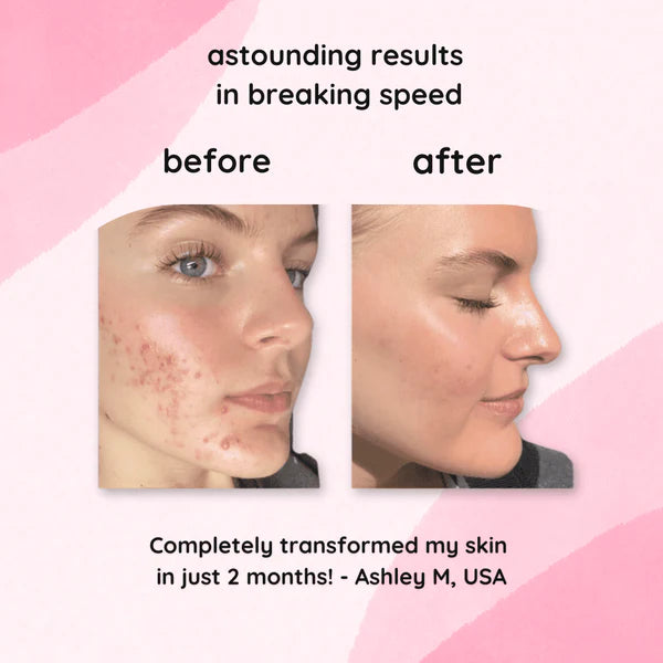 GlowFix Cleansing Pads